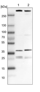 Lane 1: NIH-3T3 cell lysate (Mouse embryonic fibroblast cells)_br/_Lane 2: NBT-II cell lysate (Rat Wistar bladder tumour cells)