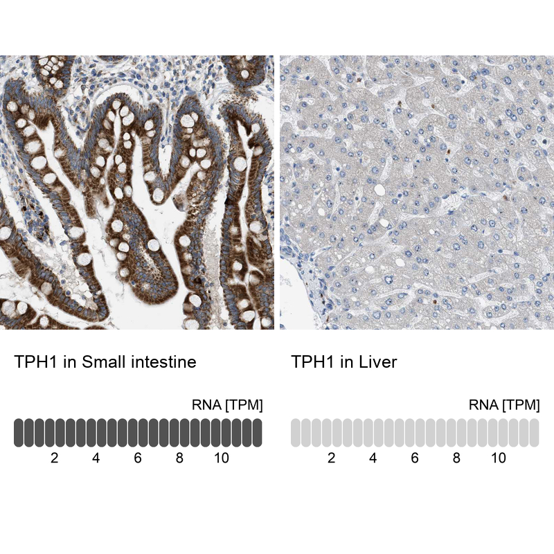Anti-TPH1 Antibody