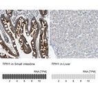 Anti-TPH1 Antibody