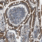 Immunohistochemical staining of human duodenum shows moderate to strong cytoplasmic positivity in glandular cells.