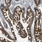 Immunohistochemical staining of human small intestine shows moderate to strong cytoplasmic positivity in glandular cells.