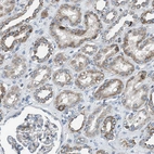 Immunohistochemical staining of human kidney shows moderate to strong cytoplasmic positivity in cells in tubules.