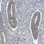 Immunohistochemical staining of human endometrium shows moderate cytoplasmic positivity in glandular cells.