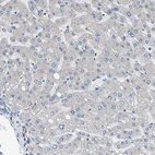 Immunohistochemical staining of human liver shows no positivity in hepatocytes as expected.