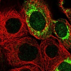 Immunofluorescent staining of human cell line A-431 shows localization to mitochondria.
