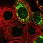 Immunofluorescent staining of human cell line A-431 shows localization to mitochondria.