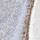 Anti-POLR1E Antibody