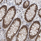 Immunohistochemical staining of human colon shows strong nucleoli positivity in glandular cells.