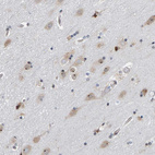 Immunohistochemical staining of human cerebral cortex shows strong nuclear positivity in neuronal cells.