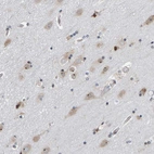 Immunohistochemical staining of human cerebral cortex shows strong nuclear positivity in neuronal cells.
