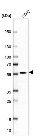 Western blot analysis in human cell line K562.