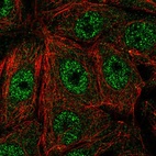 Immunofluorescent staining of human cell line MCF7 shows localization to nucleoplasm.