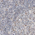 Immunohistochemical staining of human lymph node using Anti-MRM3 antibody HPA022534.