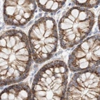 Immunohistochemical staining of human colon using Anti-MRM3 antibody HPA022534.