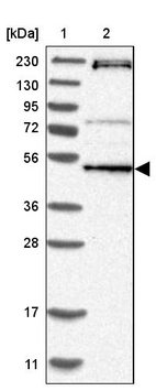 Lane 1: Marker [kDa] 230, 130, 95, 72, 56, 36, 28, 17, 11_br/_Lane 2: Human cell line RT-4