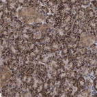 Anti-TSTD2 Antibody