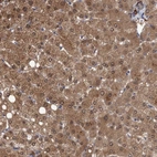 Immunohistochemical staining of human liver shows strong cytoplasmic positivity in hepatocytes.