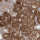 Immunohistochemical staining of human kidney shows strong cytoplasmic positivity in cells in tubules.