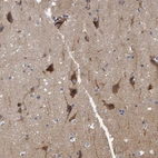 Immunohistochemical staining of human cerebral cortex shows strong cytoplasmic positivity in neurons.