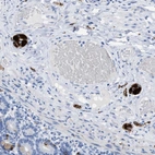 Anti-ANKFN1 Antibody