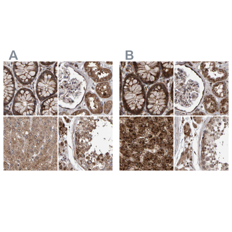 Anti-PECR Antibody