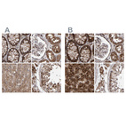 Anti-PECR Antibody
