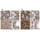 Anti-PECR Antibody