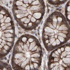 Immunohistochemical staining of human colon using Anti-PECR antibody HPA022539.