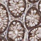 Immunohistochemical staining of human colon using Anti-PECR antibody HPA022539.