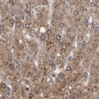 Immunohistochemical staining of human liver using Anti-PECR antibody HPA022539.
