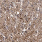 Anti-PECR Antibody