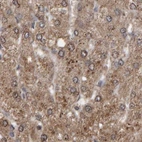 Immunohistochemical staining of human liver using Anti-PECR antibody HPA022539.