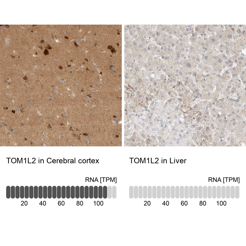 Anti-TOM1L2 Antibody
