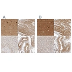 Immunohistochemical staining of human cerebral cortex, heart muscle, liver and testis using Anti-TOM1L2 antibody HPA022541 (A) shows similar protein distribution across tissues to independent antibody HPA023304 (B).