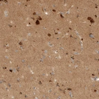 Immunohistochemical staining of human cerebral cortex shows strong cytoplasmic positivity in neurons.