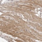 Immunohistochemical staining of human heart muscle shows moderate granular cytoplasmic positivity in cardiomyocytes.