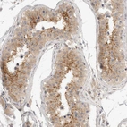 Immunohistochemical staining of human testis shows moderate granular cytoplasmic positivity in cells in seminiferous ducts.