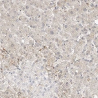Immunohistochemical staining of human liver shows very weak cytoplasmic positivity in hepatocytes.
