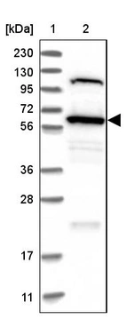Lane 1: Marker [kDa] 230, 130, 95, 72, 56, 36, 28, 17, 11_br/_Lane 2: Human cell line RT-4