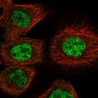 Immunofluorescent staining of human cell line A-431 shows localization to nucleoplasm.