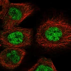 Immunofluorescent staining of human cell line A-431 shows localization to nucleoplasm.