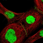 Immunofluorescent staining of human cell line A-431 shows localization to nucleus & cell junctions.