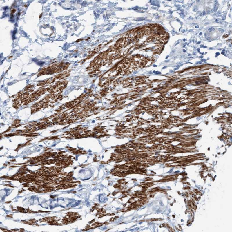 Anti-FAM187A Antibody