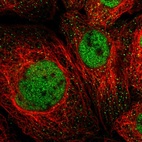 Immunofluorescent staining of human cell line A-431 shows localization to nucleoplasm.