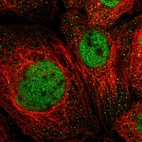 Immunofluorescent staining of human cell line A-431 shows localization to nucleoplasm.