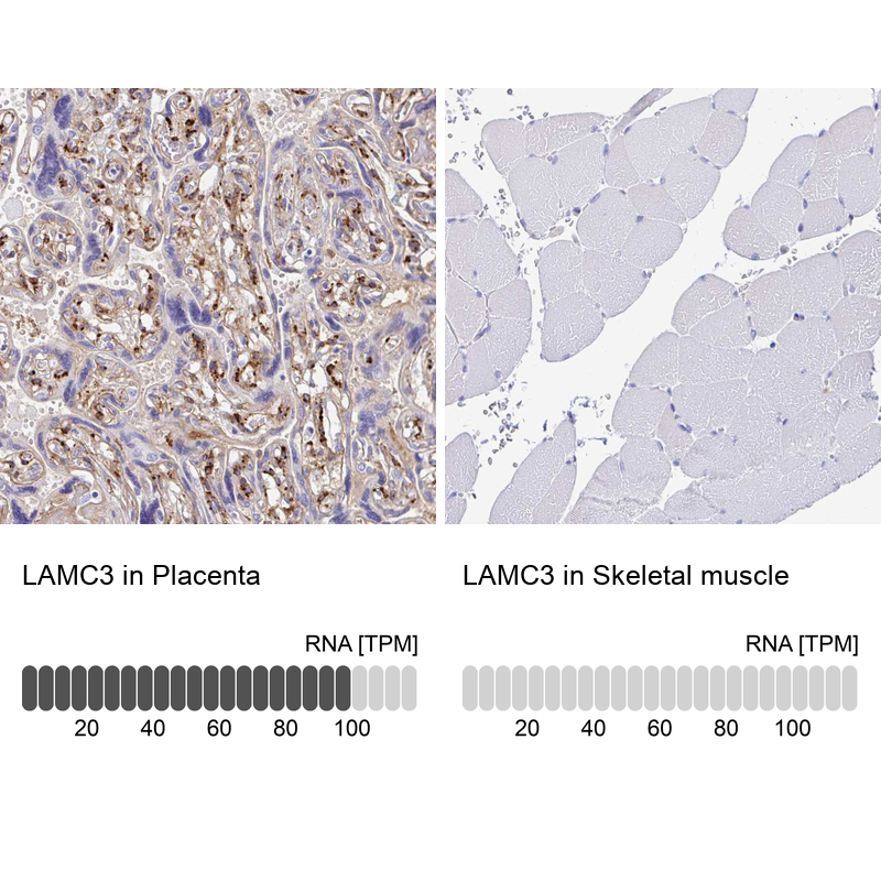 Anti-LAMC3 Antibody