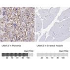 Anti-LAMC3 Antibody