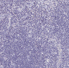 Immunohistochemical staining of human lymph node shows no positivity in non-germinal center cells as expected.
