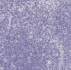 Anti-LAMC3 Antibody