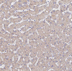 Immunohistochemical staining of human liver shows weak cytoplasmic positivity in hepatocytes.